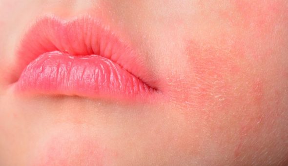 Почему чешутся губы